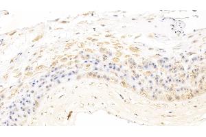 Immunohistochemistry (IHC) image for anti-Plexin B1 (PLXNB1) (AA 200-727) antibody (ABIN7438175)