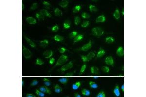 Immunofluorescence analysis of MCF-7 cells using IL7 Polyclonal Antibody (IL-7 antibody)