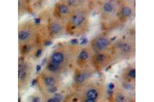 IHC-P analysis of Liver tissue, with DAB staining. (GLN1 antibody  (AA 1-373))
