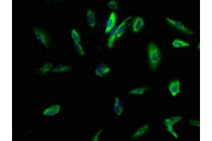 Immunofluorescence staining of U251 cells with ABIN7146342 at 1:100, counter-stained with DAPI. (KCNMB3 antibody  (AA 82-207))