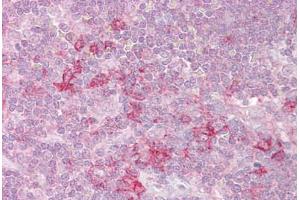 Anti-MST4 antibody IHC staining of human thymus.