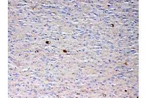 IHC analysis of NSF using anti-NSF antibody . (NSF antibody  (AA 620-744))