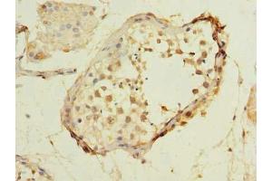 Immunohistochemistry of paraffin-embedded human testis tissue using ABIN7159074 at dilution of 1:100 (MXD3 antibody  (AA 1-206))