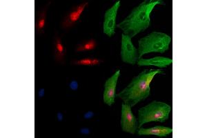 ABIN6259580 and ABIN6273739 staining  cells by IF/ICC.