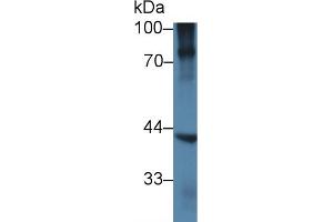 Detection of NKX6-1 in Human BXPC3 cell lysate using Polyclonal Antibody to NK6 Homeobox Protein 1 (NKX6-1)