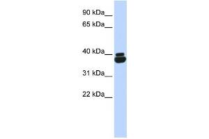 Western Blotting (WB) image for anti-Orthopedia Homeobox (OTP) antibody (ABIN2458104) (OTP antibody)