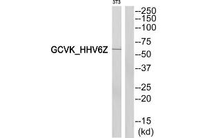 Western blot analysis of extracts from 3T3cells, using MAP2K3 antibody. (MAP2K3 antibody  (N-Term))