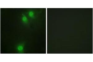 Immunofluorescence analysis of HeLa cells, using NEK9 (Phospho-Thr210) Antibody. (NEK9 antibody  (pThr210))