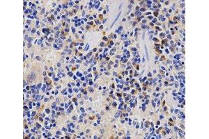 Immunohistochemistry of paraffin-embedded Rat spleen using PSMD3 Polyclonal Antibody at dilution of 1:200 (40x lens). (PSMD3 antibody)