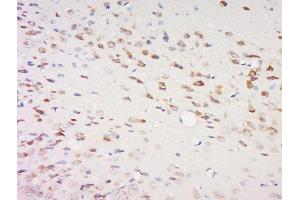 Paraformaldehyde-fixed, paraffin embedded rat brain, Antigen retrieval by boiling in sodium citrate buffer (pH6) for 15min, Block endogenous peroxidase by 3% hydrogen peroxide for 30 minutes, Blocking buffer (normal goat serum) at 37°C for 20min, Antibody incubation with	SPOCK2/Testican 2 Polyclonal Antibody, Unconjugated ( 	 at 1:200 overnight at 4°C, followed by a conjugated secondary and DAB staining. (SPOCK2/Testican 2 antibody  (AA 61-160))