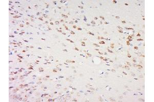 Paraformaldehyde-fixed, paraffin embedded rat brain, Antigen retrieval by boiling in sodium citrate buffer (pH6) for 15min, Block endogenous peroxidase by 3% hydrogen peroxide for 30 minutes, Blocking buffer (normal goat serum) at 37°C for 20min, Antibody incubation with	SPOCK2/Testican 2 Polyclonal Antibody, Unconjugated ( 	 at 1:200 overnight at 4°C, followed by a conjugated secondary and DAB staining. (SPOCK2/Testican 2 antibody  (AA 61-160))