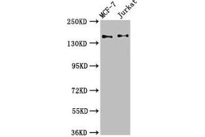 Western Blot Positive WB detected in: MCF-7 whole cell lysate, Jurkat whole cell lysate All lanes: KTN1 antibody at 3. (KTN1 antibody  (AA 978-1116))