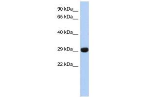 FN3KRP antibody used at 1 ug/ml to detect target protein. (FN3KRP antibody  (N-Term))