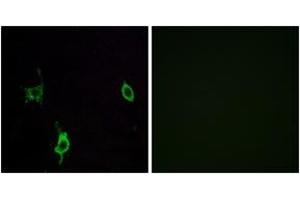 Immunofluorescence analysis of LOVO cells, using LAMC3 Antibody.