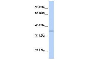 WB Suggested Anti-GRHPR Antibody Titration: 0. (GRHPR antibody  (N-Term))