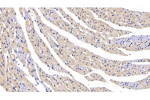 Detection of CTGF in Rat Cardiac Muscle Tissue using Polyclonal Antibody to Connective Tissue Growth Factor (CTGF) (CTGF antibody  (AA 118-388))