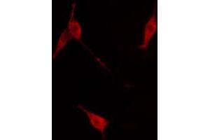 ABIN6267671 staining NIH-3T3 cells by IF/ICC. (TRKB antibody  (pTyr516))