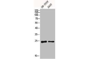 Western blot analysis of SH-SY5Y 293T using Dectin-2 antibody. (C-Type Lectin Domain Family 6, Member A (CLEC6A) (Internal Region) antibody)