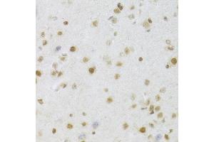 Immunohistochemistry of paraffin-embedded mouse brain using MCM4 Antibody (ABIN5971548) at dilution of 1/100 (40x lens). (MCM4 antibody)