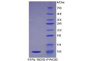 SDS-PAGE (SDS) image for Complement Component 5a (C5a) (AA 679-755) protein (His tag) (ABIN1079267)