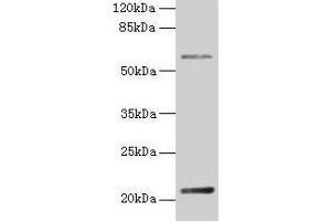 Western blot All lanes: DUSP13 antibody at 4 μg/mL + Hela whole cell lysate Secondary Goat polyclonal to rabbit IgG at 1/10000 dilution Predicted band size: 21, 23, 7, 28, 8, 10, 18 kDa Observed band size: 21 kDa