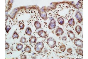 Formalin-fixed and paraffin embedded mouse intestine labeled with Rabbit Anti-Bim(Ser87) Polyclonal Antibody, Unconjugated  at 1:200 followed by conjugation to the secondary antibody and DAB staining (BIM antibody  (pSer87))