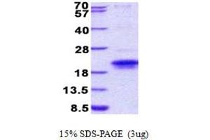 SDS-PAGE (SDS) image for IGF-like family receptor 1 (IGFLR1) (AA 23-163) protein (His tag) (ABIN5852929)