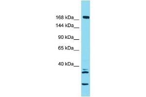 Host:  Rabbit  Target Name:  KIF27  Sample Type:  Large Intestine Tumor lysates  Antibody Dilution:  1. (KIF27 antibody  (C-Term))