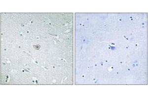 Immunohistochemistry analysis of paraffin-embedded human brain tissue, using PE2R3 Antibody. (PTGER3 antibody  (AA 1-50))