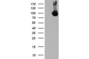 HEK293T cells were transfected with the pCMV6-ENTRY control (Left lane) or pCMV6-ENTRY DGKA (Right lane) cDNA for 48 hrs and lysed. (DGKA antibody)