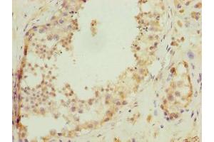 Immunohistochemistry of paraffin-embedded human testis tissue using ABIN7174751 at dilution of 1:100 (C17ORF47 antibody  (AA 1-300))