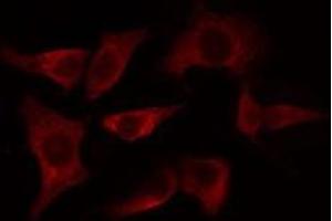 ABIN6275106 staining HeLa cells by IF/ICC. (ELOVL4 antibody  (Internal Region))