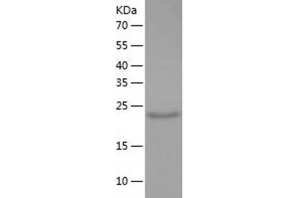 ALDH3B2 Protein (AA 56-288) (His tag)