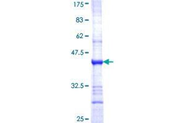 ASB4 Protein (AA 295-403) (GST tag)