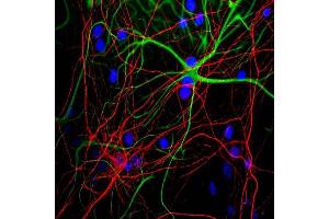 Mixed neuron/glial cultures stained with MCA- 9B12 (red) and rabbit GFAP antibody RPCA-GFAP (green). (NEFH antibody)