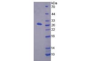 SDS-PAGE (SDS) image for 2,3-bisphosphoglycerate Mutase (BPGM) (AA 29-242) protein (His tag) (ABIN6239419)
