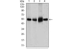 Western Blotting (WB) image for anti-Solute Carrier Family 2 (Facilitated Glucose Transporter), Member 4 (SLC2A4) (AA 224-353) antibody (ABIN1846354) (GLUT4 antibody  (AA 224-353))