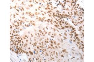 Immunohistochemistry (IHC) image for anti-Solute Carrier Family 22 (Organic Anion Transporter), Member 8 (SLC22A8) antibody (ABIN3023487) (SLC22A8 antibody)