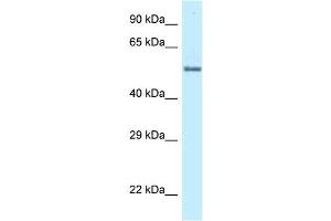 WB Suggested Anti-ZNF384 Antibody Titration: 1.