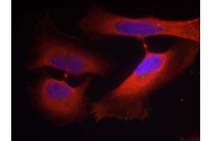 Image no. 1 for anti-Keratin 8 (KRT8) (pSer74) antibody (ABIN401539) (KRT8 antibody  (pSer74))