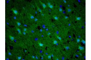 Formalin-fixed and paraffin-embedded rat brain labeled with Anti-Gemin 2 Polyclonal Antibody, Unconjugatedused at 1:200 dilution for 40 minutes at 37°C. (SIP1 antibody  (AA 51-150))