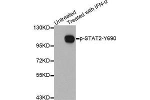 Western blot analysis of extracts from Hela cells using Phospho-STAT2-Y690 antibody. (STAT2 antibody  (pTyr690))