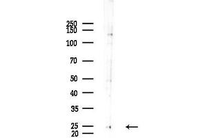 anti-A Kinase (PRKA) Interacting Protein 1 (AKIP1) (Internal Region) antibody