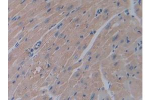 Detection of OLFM4 in Mouse Heart Tissue using Polyclonal Antibody to Olfactomedin 4 (OLFM4)