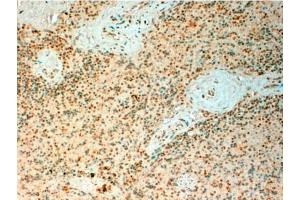 Immunohistochemistry: TET2 Antibody staining of Paraffin Embedded Human Spleen at 4 µg/ml.