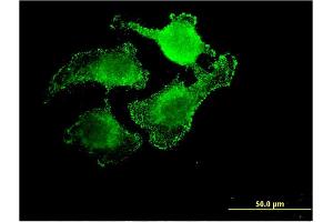 Immunofluorescence of monoclonal antibody to UNC5CL on HeLa cell.