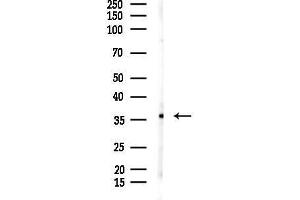 Western blot analysis of lysates from Raji cells(heat-shock,45 min treatment), using RALY Antibody at 1/1000 dilution.