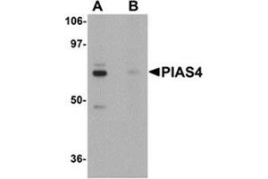 Western blot analysis of PIAS4 in rat brain tissue lysate with PIAS4 antibody at 1 μg/ml in (A) the absence and (B) the presence of blocking peptide. (PIAS4 antibody  (N-Term))