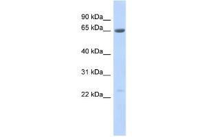 WB Suggested Anti-SSX7 Antibody Titration:  0. (SSX7 antibody  (Middle Region))