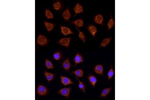 Immunofluorescence analysis of L929 using SUCL antibody (ABIN6132955, ABIN6148688, ABIN6148689 and ABIN6214151) at dilution of 1:100 (40x lens). (SUCLA2 antibody  (AA 1-180))